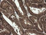 RHOJ Antibody in Immunohistochemistry (Paraffin) (IHC (P))