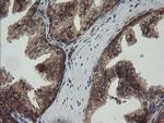 RHOJ Antibody in Immunohistochemistry (Paraffin) (IHC (P))