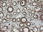 RHOJ Antibody in Immunohistochemistry (Paraffin) (IHC (P))