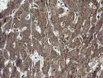 RHOJ Antibody in Immunohistochemistry (Paraffin) (IHC (P))