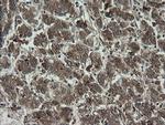 RHOJ Antibody in Immunohistochemistry (Paraffin) (IHC (P))