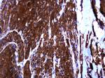 RHOJ Antibody in Immunohistochemistry (Paraffin) (IHC (P))