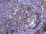 RHOJ Antibody in Immunohistochemistry (Paraffin) (IHC (P))