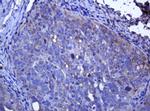 RHOJ Antibody in Immunohistochemistry (Paraffin) (IHC (P))