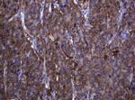 RHOJ Antibody in Immunohistochemistry (Paraffin) (IHC (P))