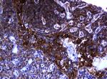RHOJ Antibody in Immunohistochemistry (Paraffin) (IHC (P))