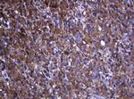 RHOJ Antibody in Immunohistochemistry (Paraffin) (IHC (P))