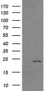 RHOJ Antibody in Western Blot (WB)
