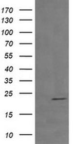 RHOJ Antibody in Western Blot (WB)