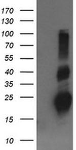 RHOJ Antibody in Western Blot (WB)