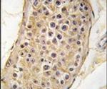 RICTOR Antibody in Immunohistochemistry (IHC)