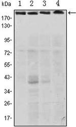 RICTOR Monoclonal Antibody (4H5)