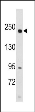 RICTOR Antibody in Western Blot (WB)