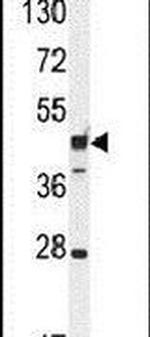 RILPL1 Antibody in Western Blot (WB)