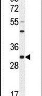RILPL2 Antibody in Western Blot (WB)