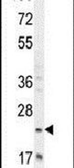 RILPL2 Antibody in Western Blot (WB)