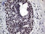 RING1 Antibody in Immunohistochemistry (Paraffin) (IHC (P))