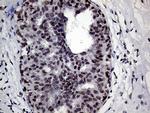 RING1 Antibody in Immunohistochemistry (Paraffin) (IHC (P))