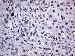 RING1 Antibody in Immunohistochemistry (Paraffin) (IHC (P))