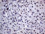 RING1 Antibody in Immunohistochemistry (Paraffin) (IHC (P))
