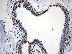RING1 Antibody in Immunohistochemistry (Paraffin) (IHC (P))