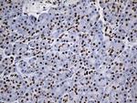 RING1 Antibody in Immunohistochemistry (Paraffin) (IHC (P))
