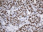 RING1 Antibody in Immunohistochemistry (Paraffin) (IHC (P))