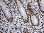 RING1 Antibody in Immunohistochemistry (Paraffin) (IHC (P))