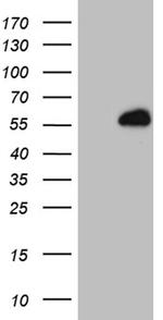 RING1 Antibody in Western Blot (WB)
