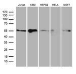 RING1 Antibody in Western Blot (WB)