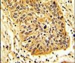 RIOK1 Antibody in Immunohistochemistry (IHC)