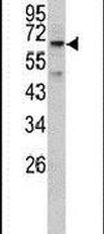 RIOK1 Antibody in Western Blot (WB)