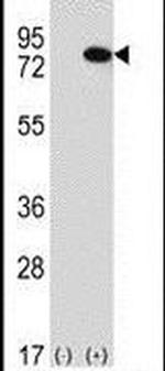 RIOK1 Antibody in Western Blot (WB)