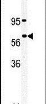 RIOK1 Antibody in Western Blot (WB)