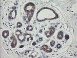 RIOK2 Antibody in Immunohistochemistry (Paraffin) (IHC (P))