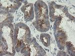 RIOK2 Antibody in Immunohistochemistry (Paraffin) (IHC (P))