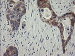 RIOK2 Antibody in Immunohistochemistry (Paraffin) (IHC (P))