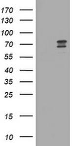 RIOK2 Antibody in Western Blot (WB)