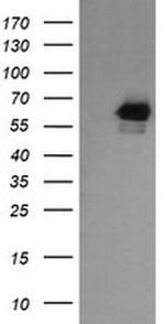 RIOK2 Antibody in Western Blot (WB)