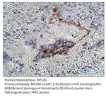 RIP140 Antibody in Immunohistochemistry (IHC)