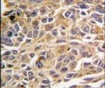 RIP3 Antibody in Immunohistochemistry (IHC)