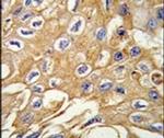 RIP3 Antibody in Immunohistochemistry (IHC)