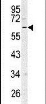 RIP3 Antibody in Western Blot (WB)