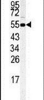 RIP3 Antibody in Western Blot (WB)