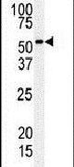 RIP3 Antibody in Western Blot (WB)