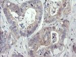RIPK1 Antibody in Immunohistochemistry (Paraffin) (IHC (P))