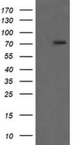 RIPK1 Antibody in Western Blot (WB)