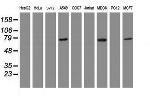 RIPK1 Antibody in Western Blot (WB)