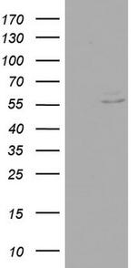 RIPK3 Antibody in Western Blot (WB)
