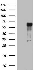 RIPK3 Antibody in Western Blot (WB)